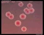 Providencia rettgeri on Endo agar